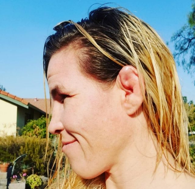 Leslie Smith MMA fighter cauliflower ear shows no-gi grappling injury risk for all athletes