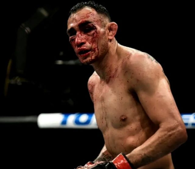 Tony Ferguson post-fight showing cauliflower ear damage from no-gi grappling and MMA