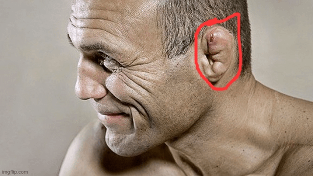 r/Grapplerbaki - why dont any of the fighters in baki suffer from cauliflower ears?