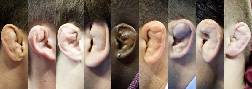 Ear Examples, Cauliflower Ears, Famous Ears, Gold Medal Wallpaper, Ear Expressions, Popcorn Ear, Human Ear Reference, Wall In