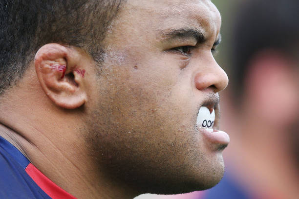 The bleeding cauliflower ears of Sam Talakai are seen during a Melbourne Rebels Super Rugby training session at Gosch's Paddo