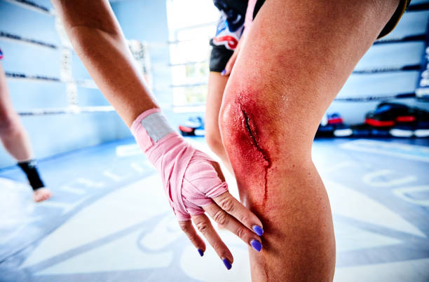 female fighter with injured knee in gym - cut knees stock pictures, royalty-free photos & images