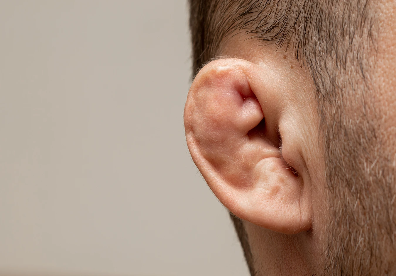 A close up of the side of a man's head, with obvious cauliflower ear.